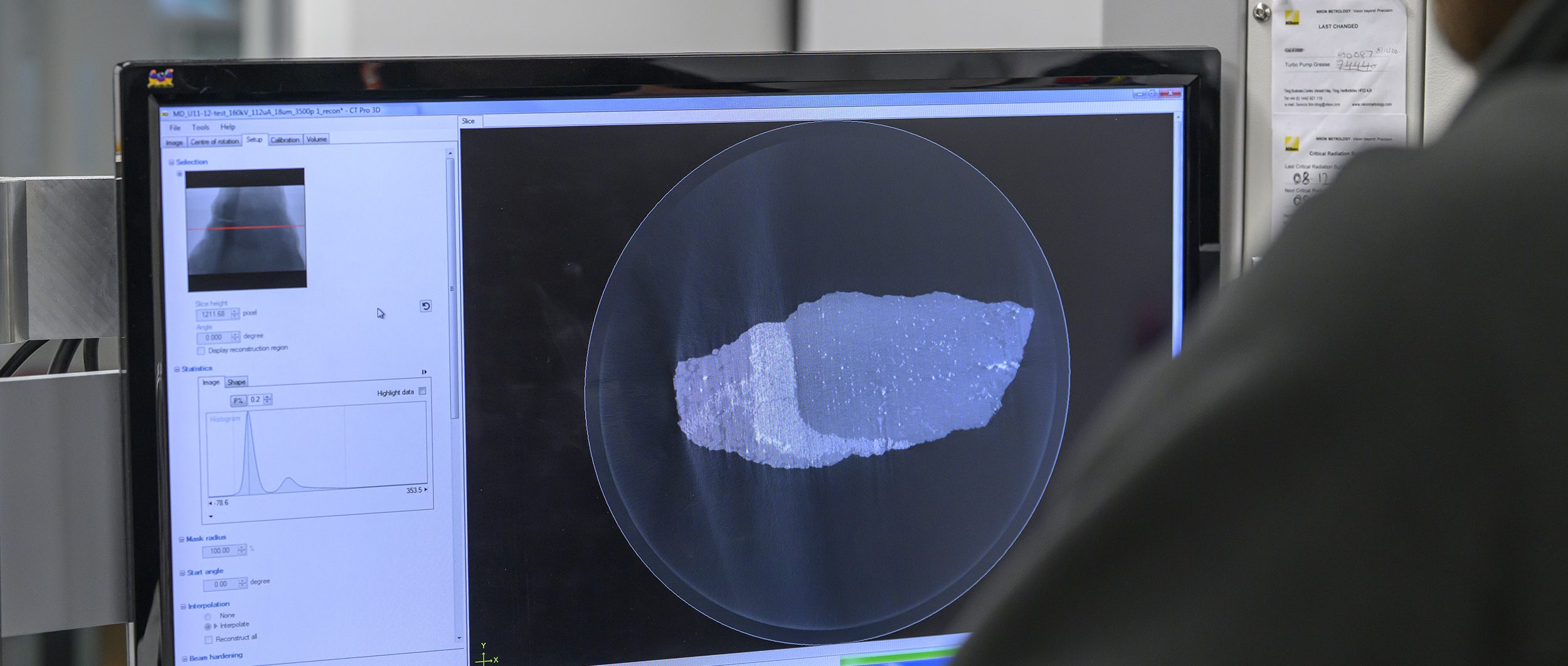 A picture of an xct scan on a computer screen